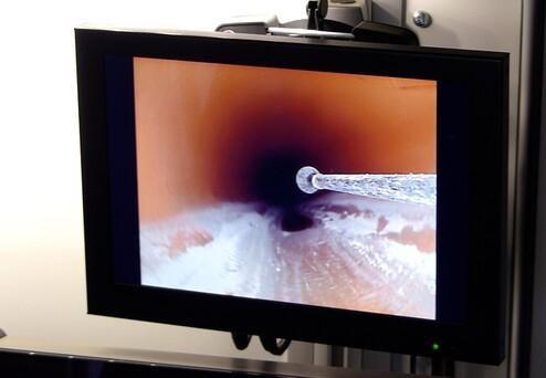 Nahaufnahme eines Endoskops, das in einen dunklen Hohlraum auf einem Monitor zeigt.